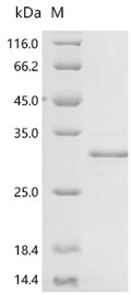 (Tris-Glycine gel) Discontinuous SDS-PAGE (reduced) with 5% enrichment gel and 15% separation gel.