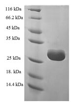 Recombinant Human Multifunctional methyltransferase subunit TRM112-like protein (TRMT112) – Figure 1 of 1