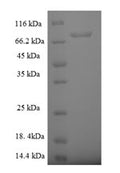 Recombinant Human Rab5 GDP/GTP exchange factor (RABGEF1) – Figure 1 of 1