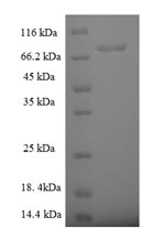 Recombinant Human Rab5 GDP/GTP exchange factor (RABGEF1) – Figure 1 of 1
