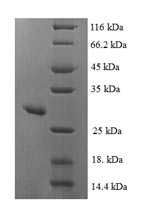 Recombinant Human Mitochondrial peptide methionine sulfoxide reductase (MSRA) – Figure 1 of 1