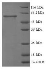 Recombinant Human N-acetyl-D-glucosamine kinase (NAGK) – Figure 1 of 1