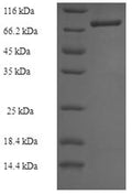 Recombinant Human Thioredoxin reductase 2, mitochondrial (TXNRD2) (U523S) – Figure 1 of 1