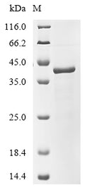 (Tris-Glycine gel) Discontinuous SDS-PAGE (reduced) with 5% enrichment gel and 15% separation gel.