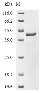 (Tris-Glycine gel) Discontinuous SDS-PAGE (reduced) with 5% enrichment gel and 15% separation gel.
