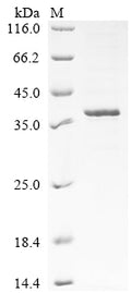 (Tris-Glycine gel) Discontinuous SDS-PAGE (reduced) with 5% enrichment gel and 15% separation gel.