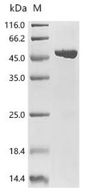 (Tris-Glycine gel) Discontinuous SDS-PAGE (reduced) with 5% enrichment gel and 15% separation gel.