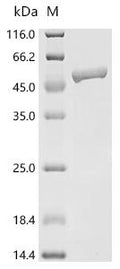 (Tris-Glycine gel) Discontinuous SDS-PAGE (reduced) with 5% enrichment gel and 15% separation gel.