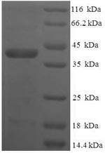 Recombinant Human Vesicle transport through interaction with t-SNAREs homolog 1B (VTI1B), partial – Figure 1 of 1