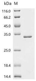 (Tris-Glycine gel) Discontinuous SDS-PAGE (reduced) with 5% enrichment gel and 15% separation gel.
