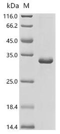 (Tris-Glycine gel) Discontinuous SDS-PAGE (reduced) with 5% enrichment gel and 15% separation gel.