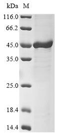 (Tris-Glycine gel) Discontinuous SDS-PAGE (reduced) with 5% enrichment gel and 15% separation gel.