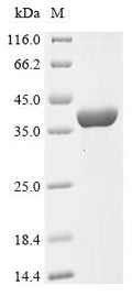 (Tris-Glycine gel) Discontinuous SDS-PAGE (reduced) with 5% enrichment gel and 15% separation gel.