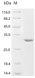 (Tris-Glycine gel) Discontinuous SDS-PAGE (reduced) with 5% enrichment gel and 15% separation gel.