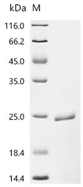 (Tris-Glycine gel) Discontinuous SDS-PAGE (reduced) with 5% enrichment gel and 15% separation gel.