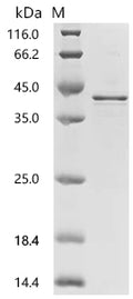 (Tris-Glycine gel) Discontinuous SDS-PAGE (reduced) with 5% enrichment gel and 15% separation gel.