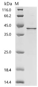 (Tris-Glycine gel) Discontinuous SDS-PAGE (reduced) with 5% enrichment gel and 15% separation gel.