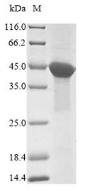 (Tris-Glycine gel) Discontinuous SDS-PAGE (reduced) with 5% enrichment gel and 15% separation gel.