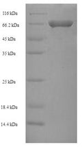 Recombinant Human Spermatogenesis-defective protein 39 homolog (SPE39) – Figure 1 of 1