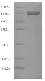 Recombinant Human Spermatogenesis-defective protein 39 homolog (SPE39) – Figure 1 of 1
