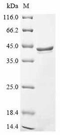 (Tris-Glycine gel) Discontinuous SDS-PAGE (reduced) with 5% enrichment gel and 15% separation gel.