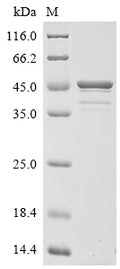 (Tris-Glycine gel) Discontinuous SDS-PAGE (reduced) with 5% enrichment gel and 15% separation gel.