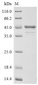 (Tris-Glycine gel) Discontinuous SDS-PAGE (reduced) with 5% enrichment gel and 15% separation gel.