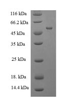 Recombinant Human Muscleblind-like protein 1 (MBNL1) – Figure 1 of 1