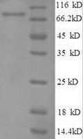 Recombinant Human E3 ubiquitin-protein ligase RAD18 (RAD18) – Figure 1 of 1