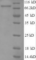 Recombinant Human E3 ubiquitin-protein ligase RAD18 (RAD18) – Figure 1 of 1