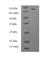 Recombinant Human ATP-dependent RNA helicase DDX19A (DDX19A) – Figure 1 of 1