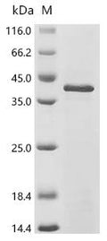 (Tris-Glycine gel) Discontinuous SDS-PAGE (reduced) with 5% enrichment gel and 15% separation gel.