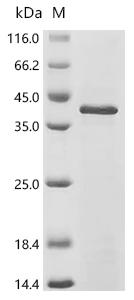 (Tris-Glycine gel) Discontinuous SDS-PAGE (reduced) with 5% enrichment gel and 15% separation gel.