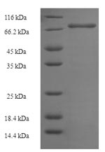 Recombinant Human Notchless protein homolog 1 (NLE1) – Figure 1 of 1