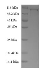 Recombinant Human Methionine synthase reductase (MTRR) – Figure 1 of 1