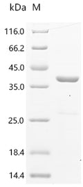 (Tris-Glycine gel) Discontinuous SDS-PAGE (reduced) with 5% enrichment gel and 15% separation gel.