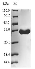 (Tris-Glycine gel) Discontinuous SDS-PAGE (reduced) with 5% enrichment gel and 15% separation gel.