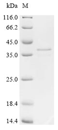 (Tris-Glycine gel) Discontinuous SDS-PAGE (reduced) with 5% enrichment gel and 15% separation gel.