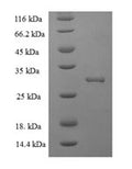 Recombinant Human Hematological and neurological expressed 1 protein (HN1) – Figure 1 of 1