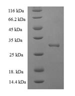 Recombinant Human Hematological and neurological expressed 1 protein (HN1) – Figure 1 of 1