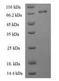 Recombinant Human BAG family molecular chaperone regulator 5 (BAG5) – Figure 1 of 1