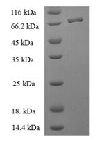 Recombinant Human BAG family molecular chaperone regulator 5 (BAG5) – Figure 1 of 1
