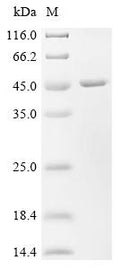 (Tris-Glycine gel) Discontinuous SDS-PAGE (reduced) with 5% enrichment gel and 15% separation gel.