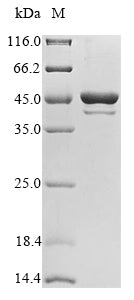 (Tris-Glycine gel) Discontinuous SDS-PAGE (reduced) with 5% enrichment gel and 15% separation gel.