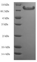 Recombinant Human Angiopoietin-related protein 2 (ANGPTL2) – Figure 1 of 1