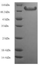 Recombinant Human Angiopoietin-related protein 2 (ANGPTL2) – Figure 1 of 1