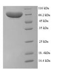 Recombinant Human Protein-arginine deiminase type-1 (PADI1) – Figure 1 of 1