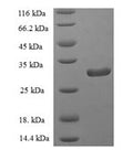 Recombinant Human Group IID secretory phospholipase A2 (PLA2G2D), partial – Figure 1 of 1