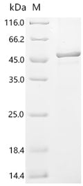 (Tris-Glycine gel) Discontinuous SDS-PAGE (reduced) with 5% enrichment gel and 15% separation gel.