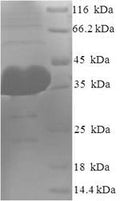 Recombinant Human Protein argonaute-2 (AGO2), partial – Figure 1 of 1